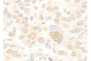 anti-serine/arginine-Rich Splicing Factor 10 (SRSF10) (AA 133-183) antibody