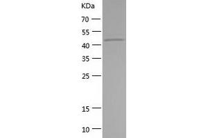 Western Blotting (WB) image for serpin Peptidase Inhibitor, Clade B (Ovalbumin), Member 4 (SERPINB4) (AA 1-390) protein (His tag) (ABIN7286250) (SERPINB4 Protein (AA 1-390) (His tag))