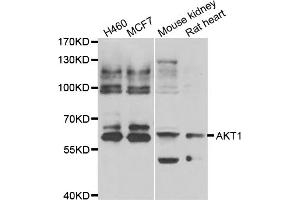 Western blot analysis of extracts of various cell lines, using AKT1 antibody (ABIN5974372).