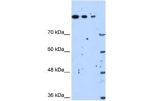 Western Blot showing SETD2 antibody used at a concentration of 1. (SETD2 antibody  (N-Term))