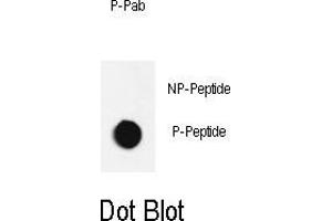 Dot blot analysis of anti-Phospho-JNK1-/ Phospho-specific Pab (ABIN650889 and ABIN2839831) on nitrocellulose membrane.