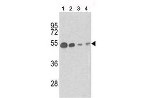 Western blot analysis of b-Tubulin antibody and (1) mouse brain tissue, (2) Y79, (3) CEM and (4) 293 lysate. (TUBB1 antibody)