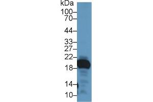 Detection of GKN2 in Mouse Stomach lysate using Polyclonal Antibody to Gastrokine 2 (GKN2) (Gastrokine 2 antibody  (AA 21-184))