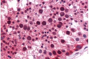 Human Testis: Formalin-Fixed, Paraffin-Embedded (FFPE) (KLF9 antibody  (AA 38-87))