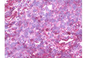 IHC with PSMD10 antibody on frozen human tonsil.