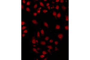 ABIN6267394 staining HeLa by IF/ICC. (RPA2 antibody  (pThr21))