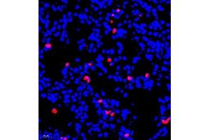 Immunofluorescent analysis of paraffin embedded mouse lung using S100A9 (ABIN7075497) at dilution of 1: 900 (S100A9 antibody)