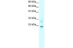 WB Suggested Anti-CLDN9 Antibody Titration:  2. (Claudin 9 antibody  (C-Term))