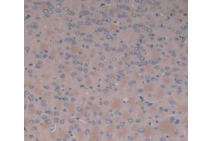 DAB staining on IHC-P; Samples: Rat Brain Tissue. (SERPINA6 antibody  (AA 173-344))