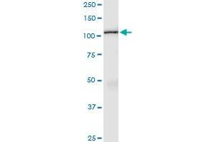 Immunoprecipitation of AMOTL1 transfected lysate using anti-AMOTL1 MaxPab rabbit polyclonal antibody and Protein A Magnetic Bead , and immunoblotted with AMOTL1 purified MaxPab mouse polyclonal antibody (B01P) . (AMOTL1 antibody  (AA 1-956))