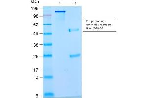 SDS-PAGE Analysis Purified Pan-Nuclear Antigen Monoclonal Antibody (NM2984R). (Recombinant Nuclear Antigen (Pan-Nuclear Marker) antibody)