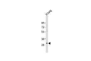 Anti-KLK6 Antibody (A13)at 1:2000 dilution + human lung lysates Lysates/proteins at 20 μg per lane. (Kallikrein 6 antibody  (N-Term))