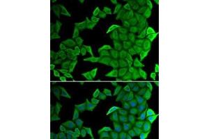 Immunofluorescence analysis of U2OS cells using SMYD2 Polyclonal Antibody (SMYD2A antibody)