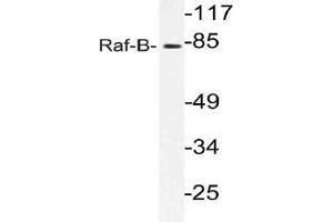 Western blot (WB) analysis of Raf-B antibody in extracts from 293 cells. (BRAF antibody)