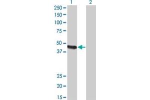 Carboxypeptidase A2 antibody  (AA 117-206)