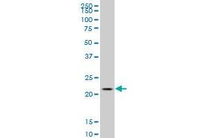 C1orf57 polyclonal antibody (A01), Lot # 060613JCS1 Western Blot analysis of C1orf57 expression in MES-SA/Dx5 . (C1orf57 antibody  (AA 91-190))