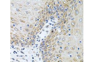 Immunohistochemistry of paraffin-embedded Human esophagus using CPM Polyclonal Antibody at dilution of 1:100 (40x lens). (CPM antibody)