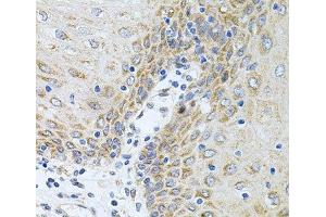 Immunohistochemistry of paraffin-embedded Human esophagus using CPM Polyclonal Antibody at dilution of 1:100 (40x lens).
