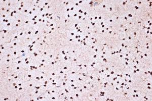 Immunohistochemistry of paraffin-embedded rat brain using KHSRP Rabbit mAb (ABIN7268110) at dilution of 1:100 (40x lens). (KHSRP antibody)