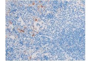 ABIN6255701 and ABIN6267554 at 1/200 staining Mouse spleen tissue sections by IHC-P.