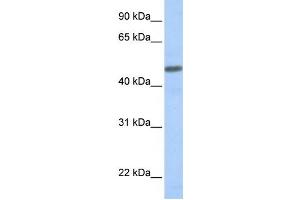 Western Blotting (WB) image for anti-Calcitonin Receptor-Like (CALCRL) antibody (ABIN2458637) (CALCRL antibody)