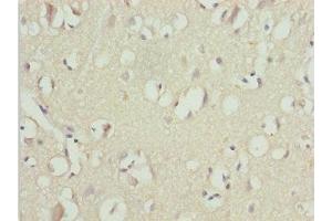 Immunohistochemistry of paraffin-embedded human brain tissue using ABIN7174528 at dilution of 1:100