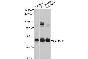 Western blot analysis of extracts of various cell lines, using SLC30A6 Antibody (ABIN4905198) at 1:3000 dilution.