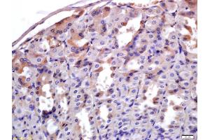 Formalin-fixed and paraffin embedded mouse stomach labeled with Anti-ADAM28 Polyclonal Antibody, Unconjugated (ABIN758861) at 1:200 followed by conjugation to the secondary antibody and DAB staining (ADAM28 antibody  (AA 321-420))