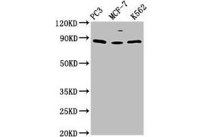 Western Blot Positive WB detected in: PC-3 whole cell lysate, MCF-7 whole cell lysate, K562 whole cell lysate All lanes: TRIM28 antibody at 1. (KAP1 antibody  (AA 22-291))
