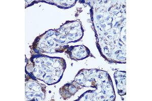 Immunohistochemistry of paraffin-embedded Human placenta using TBCCD1 Rabbit pAb (ABIN7270751) at dilution of 1:100 (40x lens). (TBCCD1 antibody)
