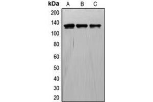 Western blot analysis of TIE1 expression in A549 (A), ECV304 (B), NIH3T3 (C) whole cell lysates.