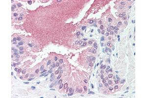 Anti-SLITRK6 antibody IHC of human prostate. (SLITRK6 antibody  (Cytoplasmic Domain))