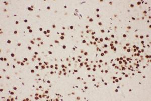 Anti-ALOX5 Picoband antibody,  IHC(P): Rat Brain Tissue (ALOX5 antibody  (AA 120-483))