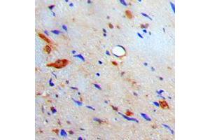 Immunohistochemical analysis of S100-A10 staining in human brain formalin fixed paraffin embedded tissue section. (S100A10 antibody  (Center))