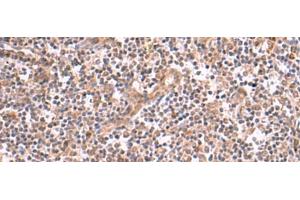 Immunohistochemistry of paraffin-embedded Human tonsil tissue using SLC12A7 Polyclonal Antibody at dilution of 1:50(x200) (SLC12A7 antibody)