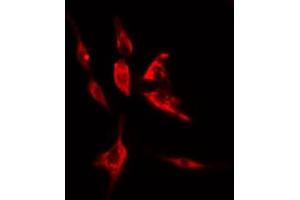 ABIN6274998 staining LOVO cells by IF/ICC. (CLN5 antibody  (Internal Region))