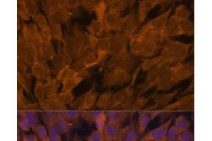 Immunofluorescence analysis of C6 cells using STAM2 Polyclonal Antibody at dilution of 1:100. (STAM2 antibody)