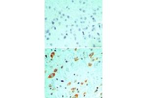 Immunohistochemical analysis of TLR5 in formalin-fixed, paraffin-embedded mouse brain tissue using an isotype control (top) and TLR5 monoclonal antibody, clone 19D759. (TLR5 antibody  (AA 700-800))