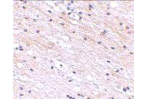 Immunohistochemical staining of human brain tissue with 2. (SATB1 antibody  (N-Term))