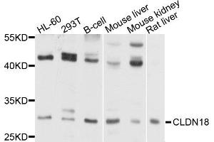 Western blot analysis of extract of various cells, using CLDN18 antibody.
