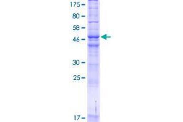 ARV1 Protein (AA 1-271) (GST tag)