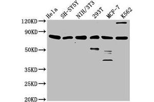 Western Blot Positive WB detected in: Hela whole cell lysate, SH-SY5Y whole cell lysate, NIH/3T3 whole cell lysate, 293T whole cell lysate, MCF-7 whole cell lysate, K562 whole cell lysate All lanes: KMT2E antibody at 3. (MLL5/KMT2E antibody  (AA 182-316))