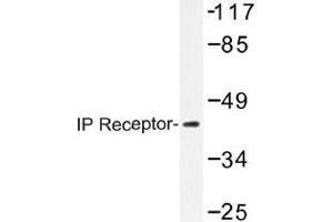 Image no. 1 for anti-Prostacyclin Receptor (PTGIR) antibody (ABIN317863)