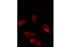 ABIN6278125 staining Hela by IF/ICC. (UNG antibody  (Internal Region))