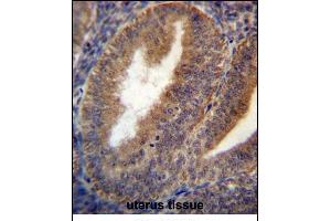 RRAGC Antibody (Center) (ABIN657008 and ABIN2846188) immunohistochemistry analysis in formalin fixed and paraffin embedded human uterus tissue followed by peroxidase conjugation of the secondary antibody and DAB staining. (GTR2 antibody  (AA 169-198))