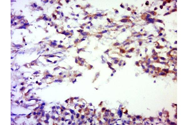 SERPINB12 antibody