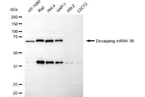Western blotting analysis using decapping mRNA 1B antibody (ABIN7798281).