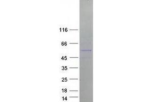 TRIM50 Protein (Myc-DYKDDDDK Tag)