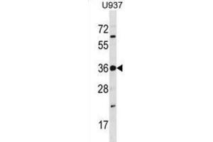 Western Blotting (WB) image for anti-TP53 Regulating Kinase (TP53RK) antibody (ABIN3003681) (TP53RK antibody)