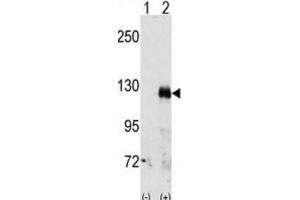 Western Blotting (WB) image for anti-EPH Receptor A3 (EPHA3) antibody (ABIN3003329) (EPH Receptor A3 antibody)